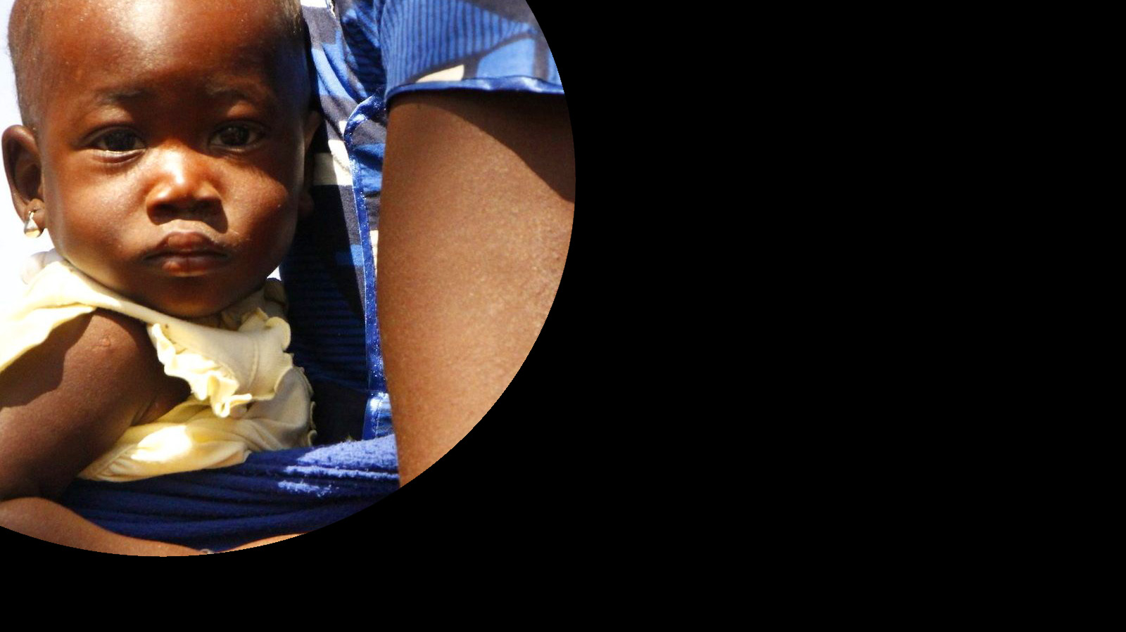La santé au Sénégal La santé au Sénégal
